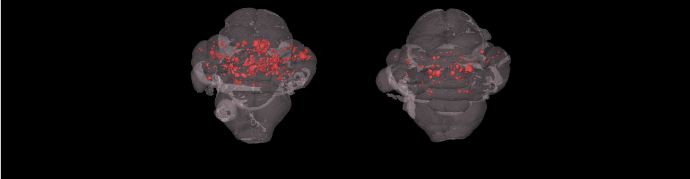 MicroCT rendering of CCM lesions from Hong et al. 2020, Journal of Experimental Medicine.